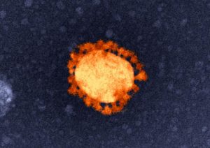 Outbreaks sites listed in Cardinia