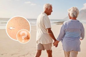 Get a skin cancer check before summer