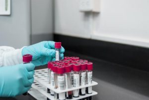 Push for at risk Victorians to get tested for hepatitis B
